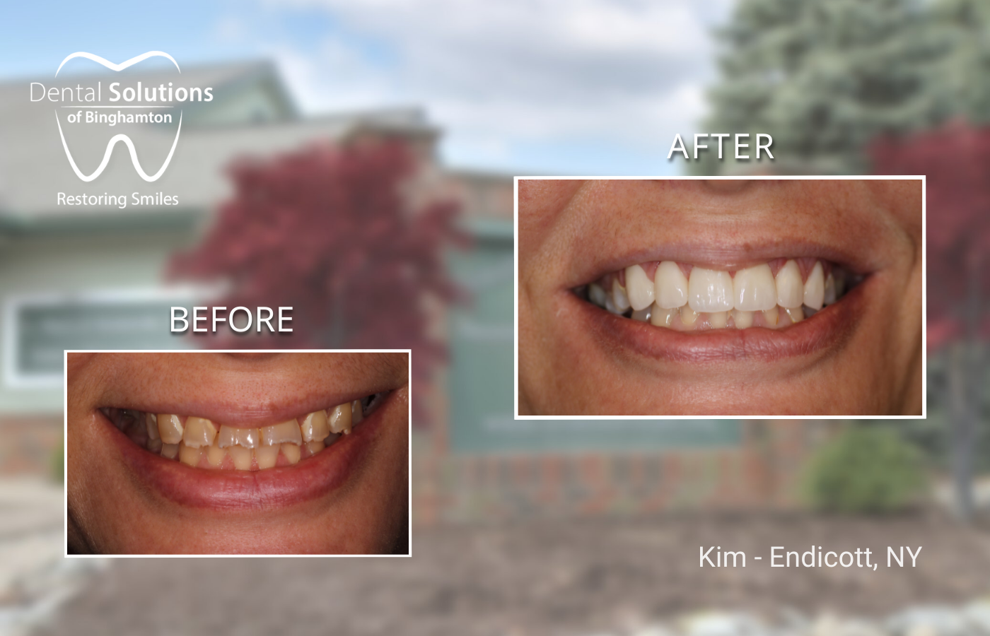 Kim - Endicott, NY